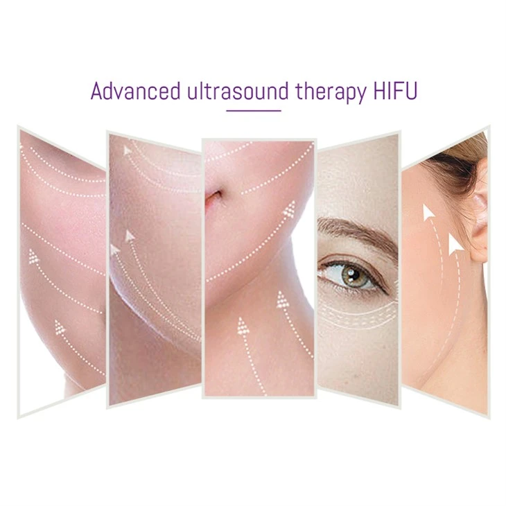 Skin Tightening HIFU Machine For Face And Body Contouring factory